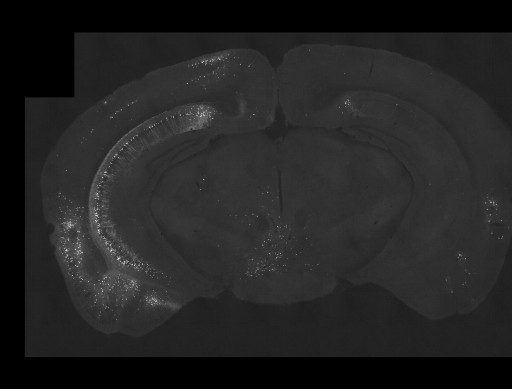 prefrontal cortex microscopy